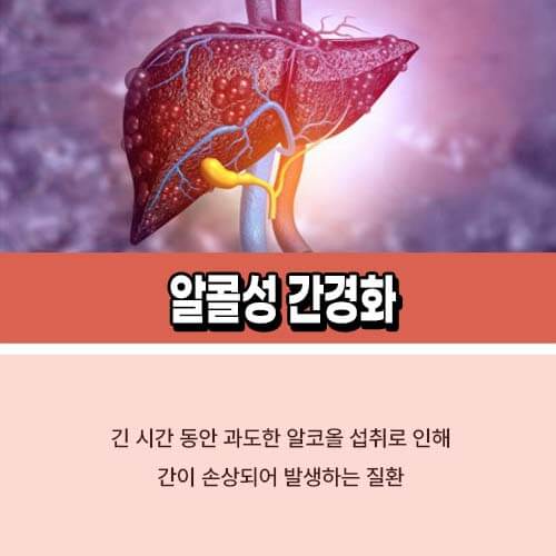 알콜성 간경화