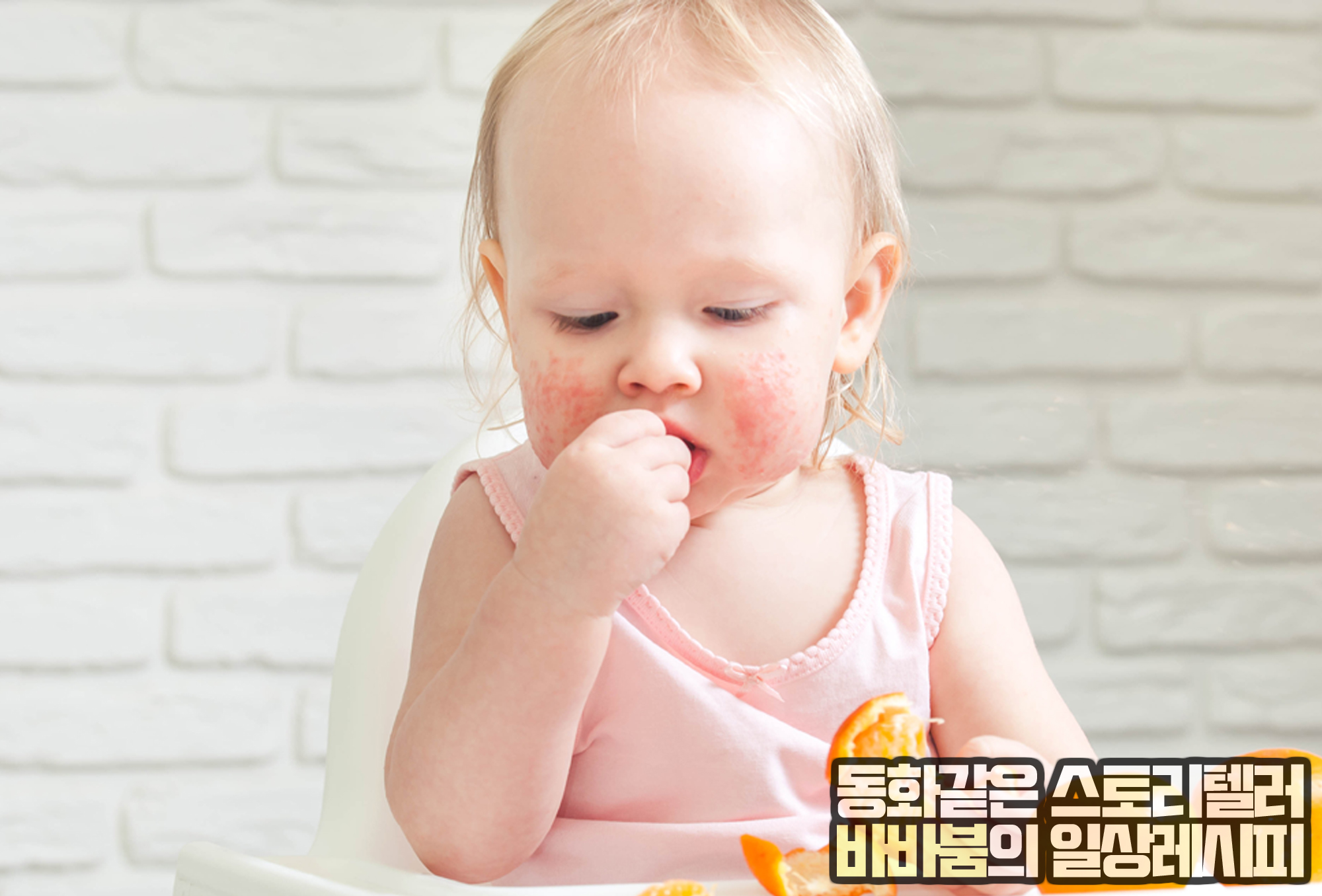  아기에게 생기는 붉은 반점 '혈관종', 증상 및 치료의 모든 것!