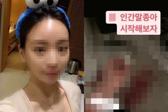  황하나 4억 외제 차 도난 주장 자해 힘들고 지쳐 인간말종 시작