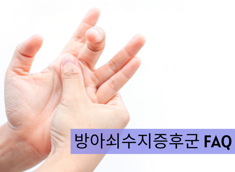 방아쇠수지증후군