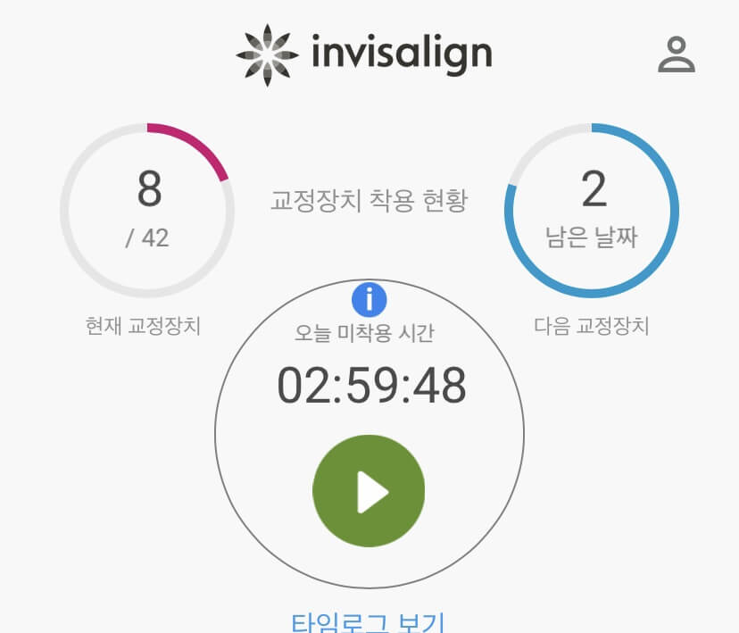 인비절라인 교정 도움 앱 화면과 장치 착용시간 체크 방법
