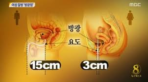 방광염의 약에 대한 효능과 주의할 점