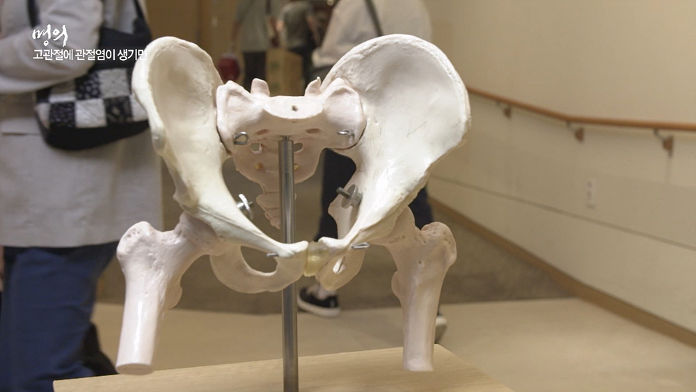 EBS 826회 명의 고관절 질환 - 인공관절로 걷다, 수술 후 합병증, 부작용 및 생활 관리, 퇴행성 관절염, 골절, 대퇴골두무혈성 괴사 치료 방법 강북 삼성병원 박윤수 박재형 교수