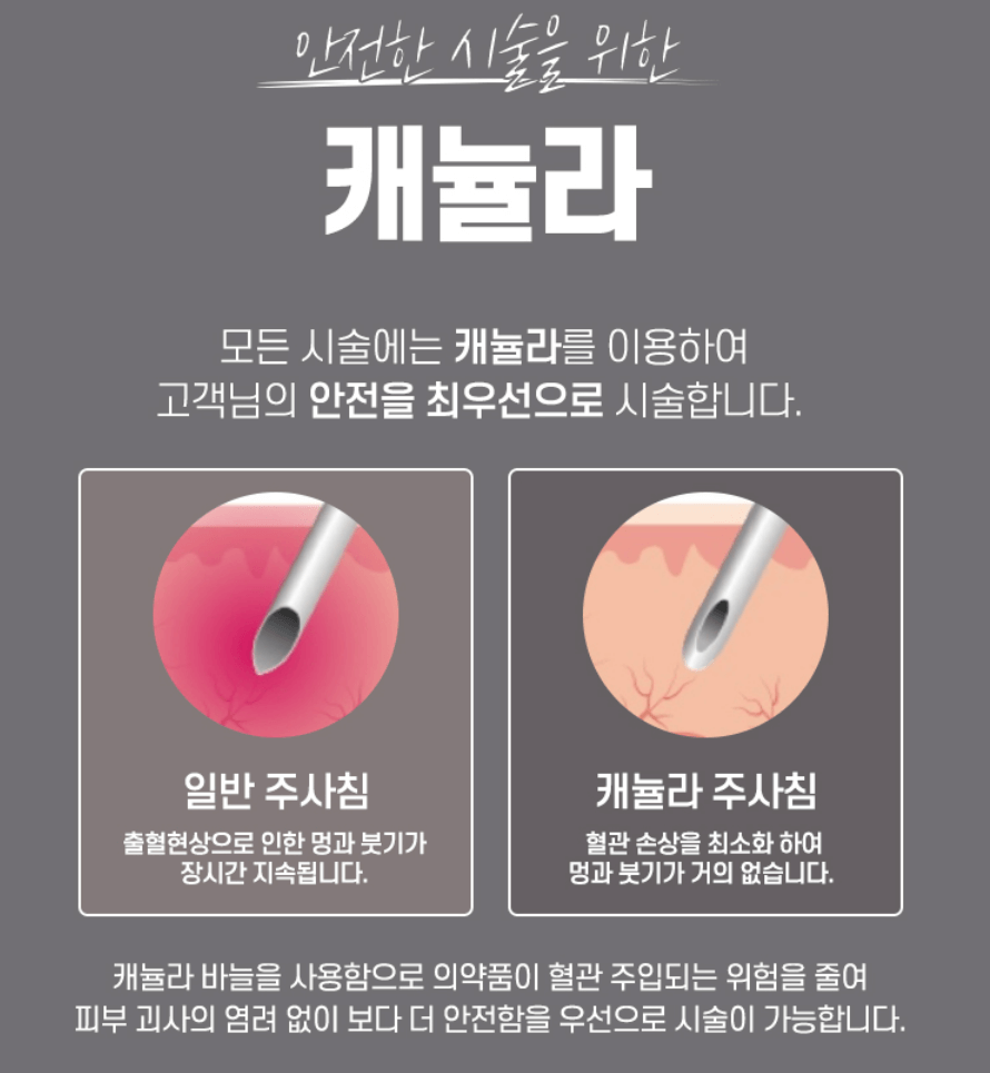 이마 필러 가격 효과 부작용 후기