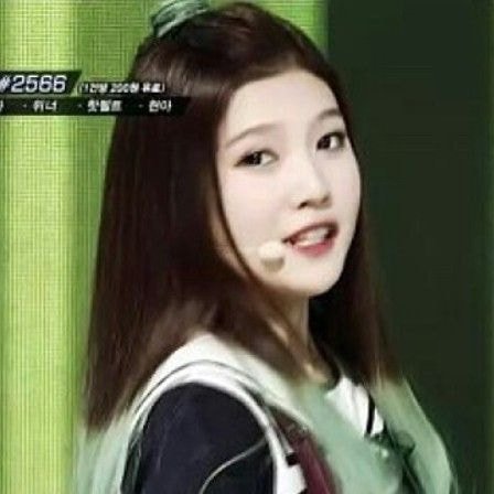  헤어라인 교정이 신의한수같은 연예인들