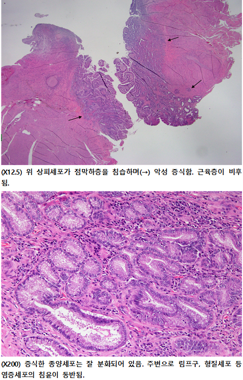 수술 후 마시티닙 항암치료 13살 노령견 강아지 위암 7