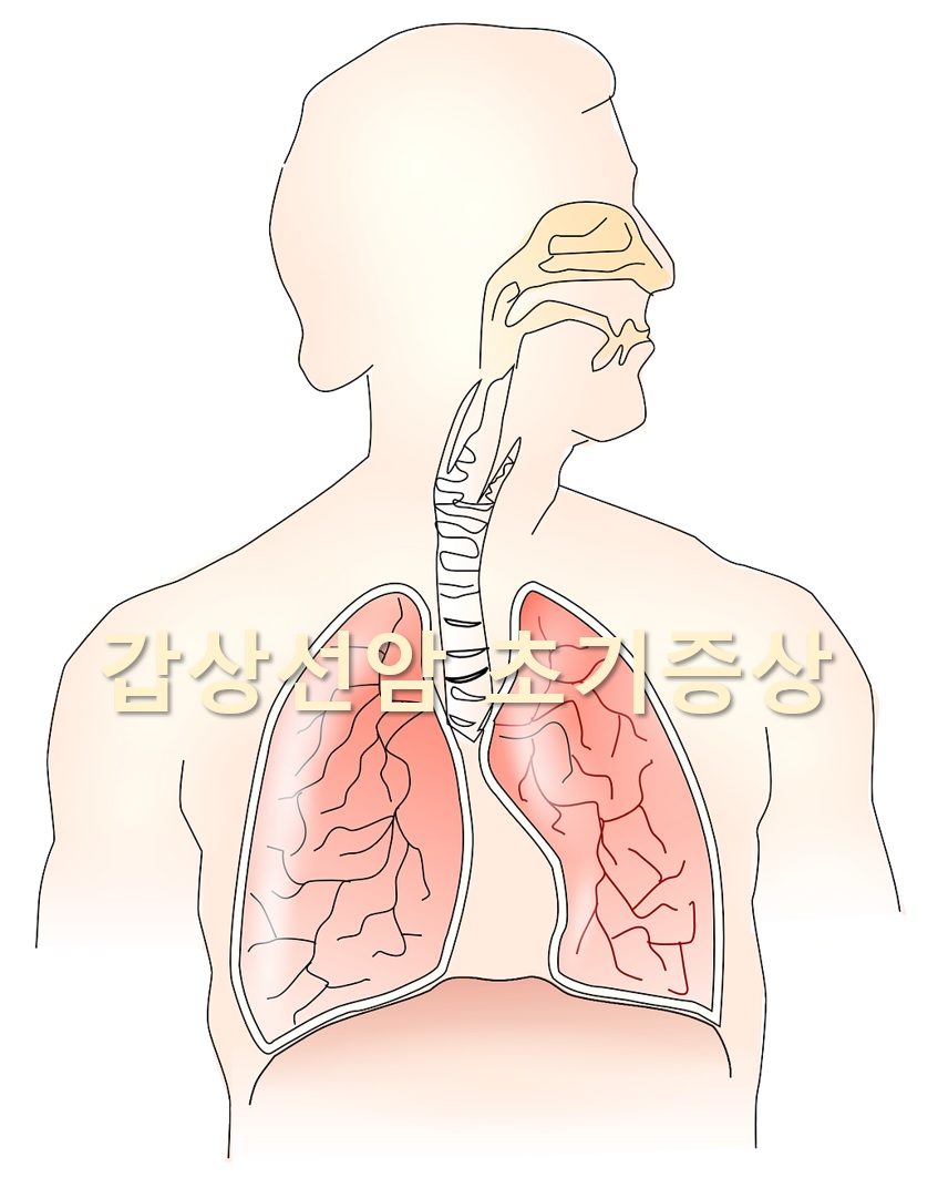 갑상선 초음파를 통한 갑상선암 검사 방법