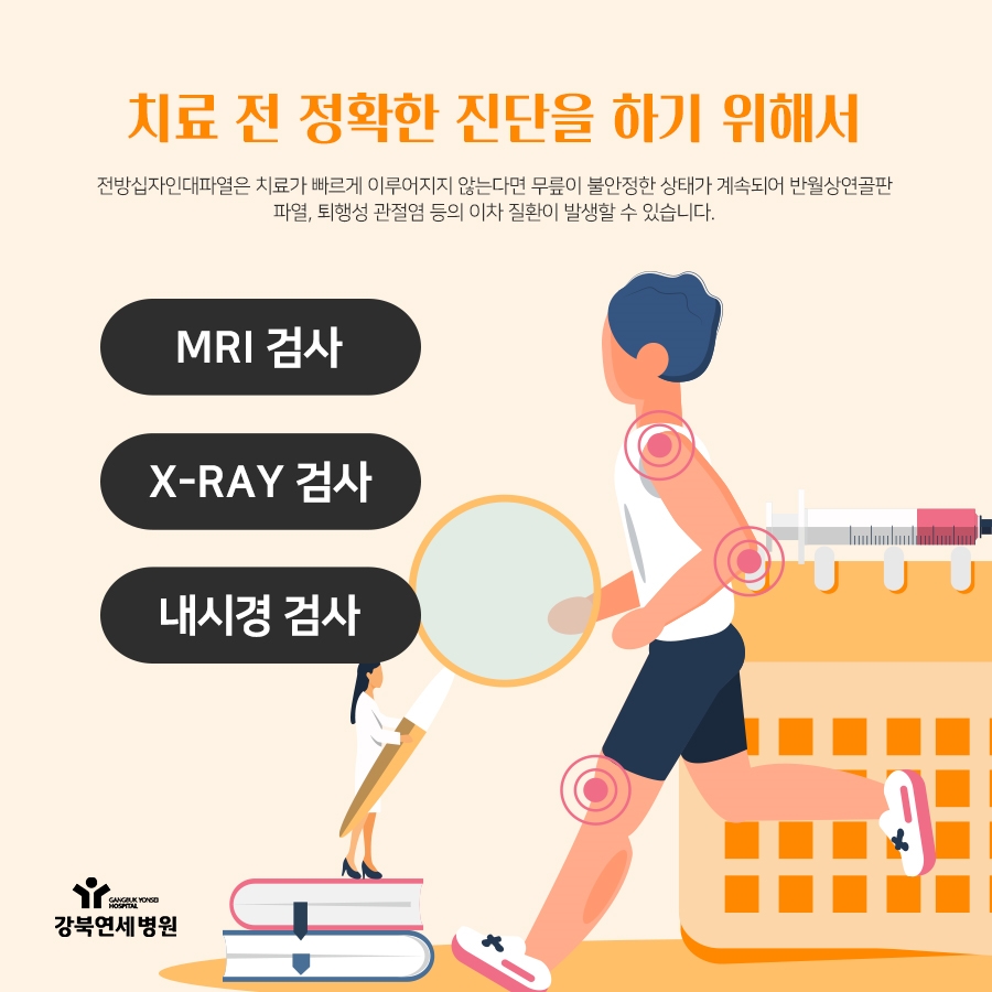 두 가닥 복원술 전방십자인대재건술 안정성을 높인 4
