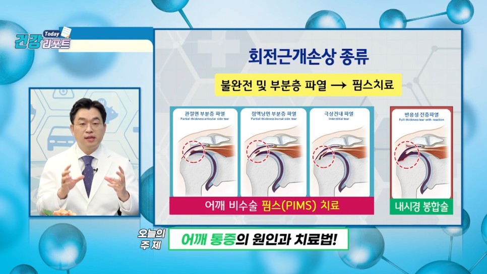 핌스 이미지