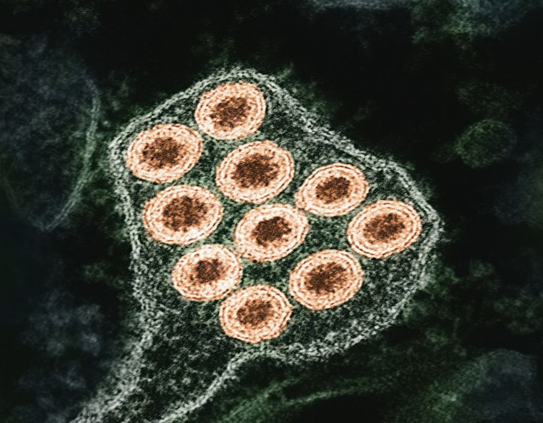 Measles