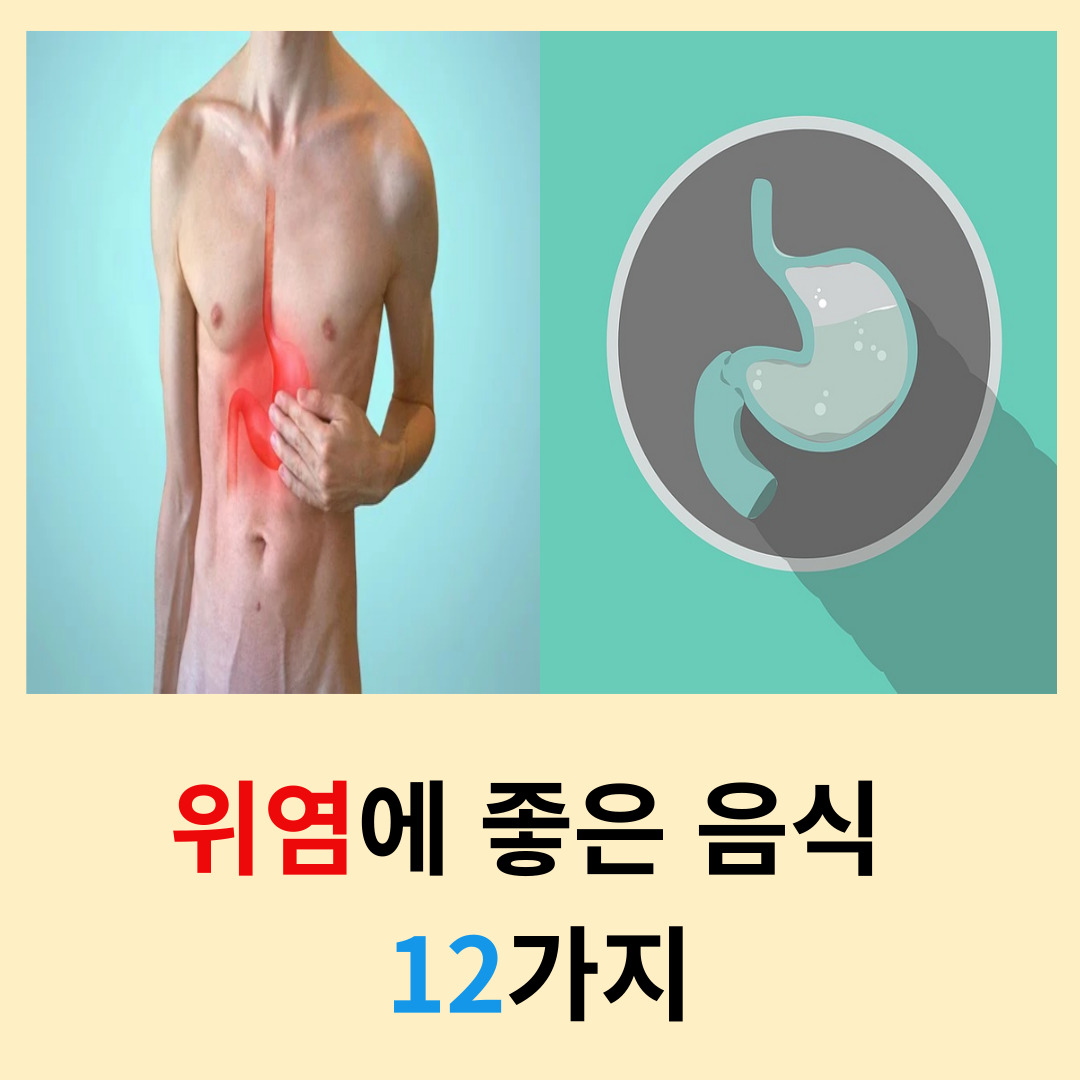 위염에-좋은-음식-12가지