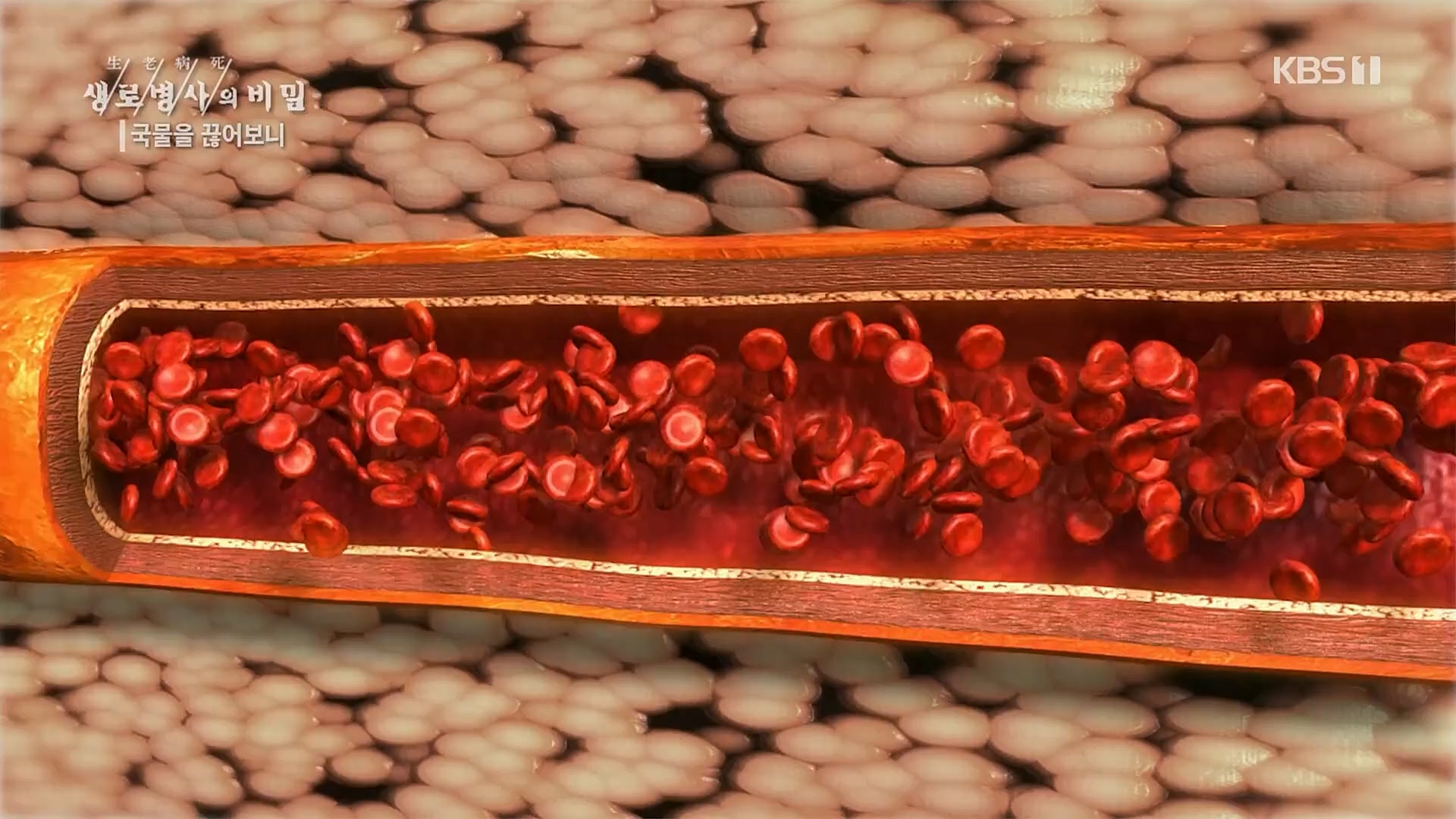 생로병사의 비밀.E854.230201p.H264-F1RST.mp4_20230212_140054.459.jpg