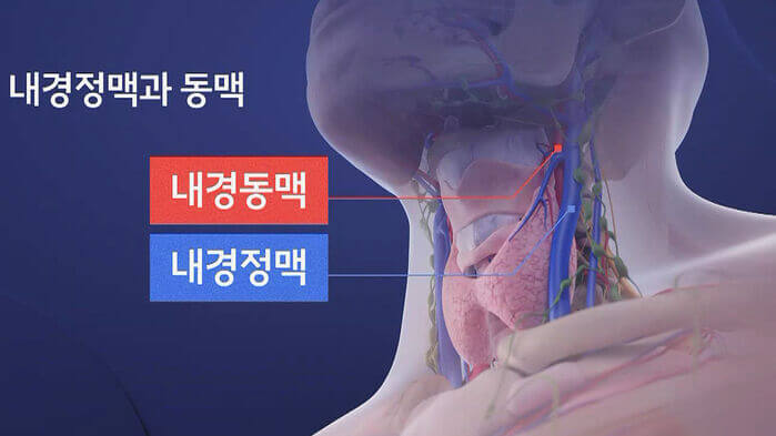 내경정맥과-동맥