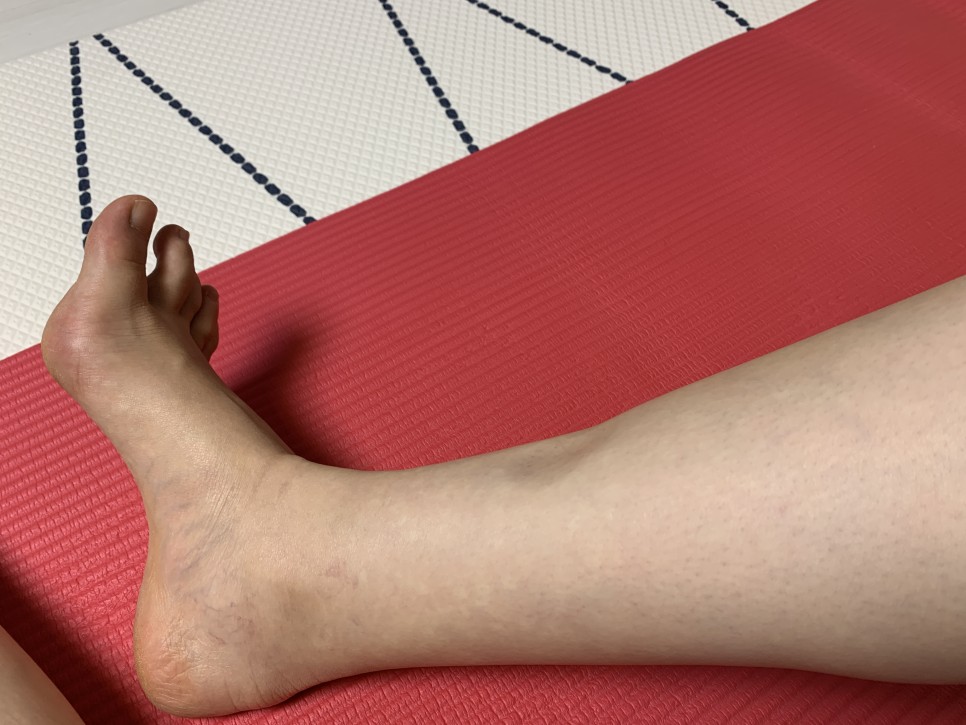 통증, 의료용 압박 스토킹 후기, 아기 크기, 체중, 증상, 태동, 배 크기, 우정 사진 촬영 30-34주 주물 사진 : 출산 휴가, 산전 우울증, 포유문 산부인과 산전 마사지, 다리 붓기, 손가락 5