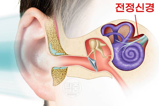 어지럼증 원인 귓병 어지러움 원인 전정신경염