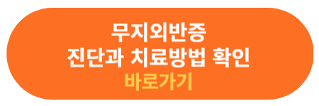 무지외반증 진단과 치료 방법 확인