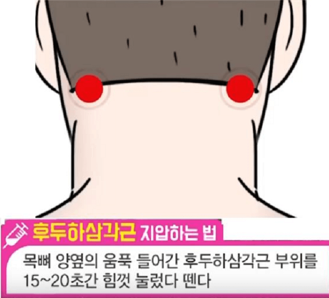 후두하근스트레칭방법사진