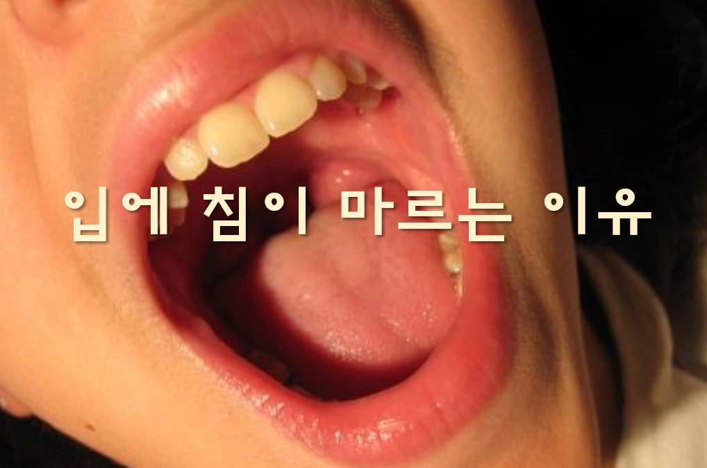  입에 침이 많이 고이는 이유와 마르는 이유