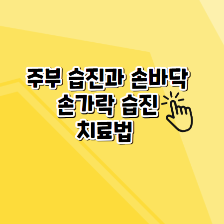 주부 습진과 손바닥&#44; 손가락 습진 치료법 (증상&#44; 원인&#44; 예방법)