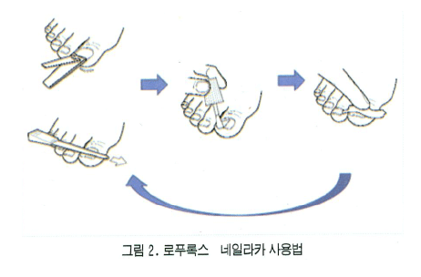 로푸록스-네일라카-사용법