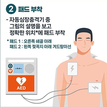 자동심장충격기(AED)-2패드부착