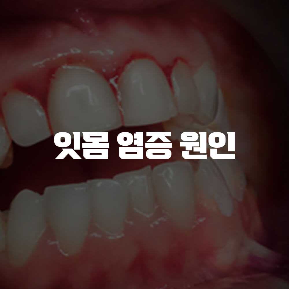 잇몸 염증 원인