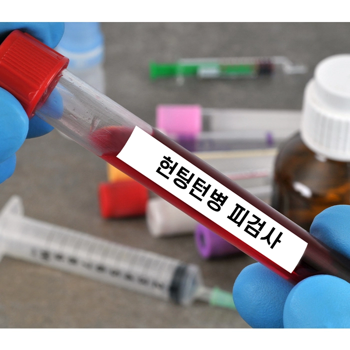  레밍턴병 (레밍턴증후군) 이란?