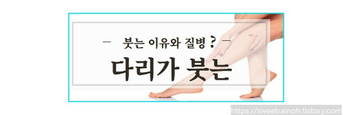 다리-사진