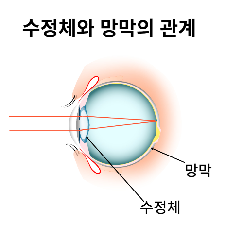  생활과 과학-시력교정술의 과학적 원리-라섹, 라식, 렌즈삽입술의 차이, 과학 상식, 안경의 원리, 빛의 굴절