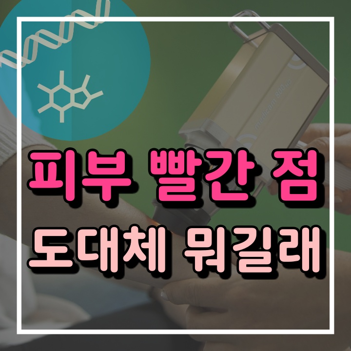  피부 빨간 점  원인과 제거 (버찌혈관종, 체리혈관종)