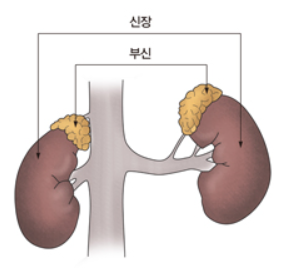  쿠싱증후군 증상/원인/치료 알아보기