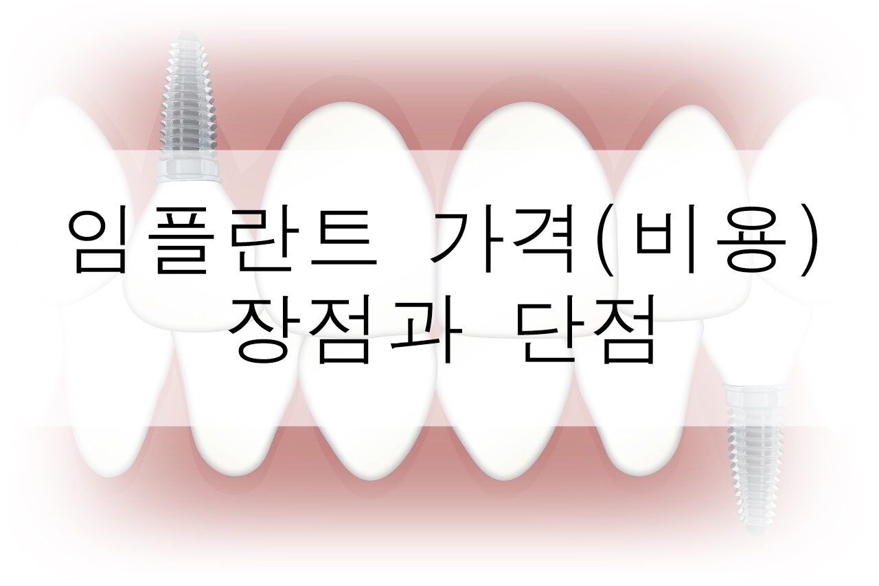 임플란트 가격(비용)과 장점과 단점을 알아봐요!