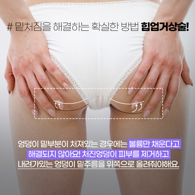 밑처짐을 해결하는 가장 확실한 방법 힙업거상수술