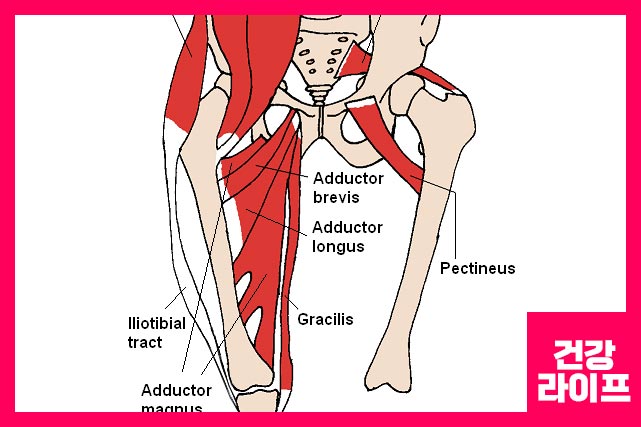 허벅지 상부에 혈전이 발견될 경우 통증이 나타날 수 있다.