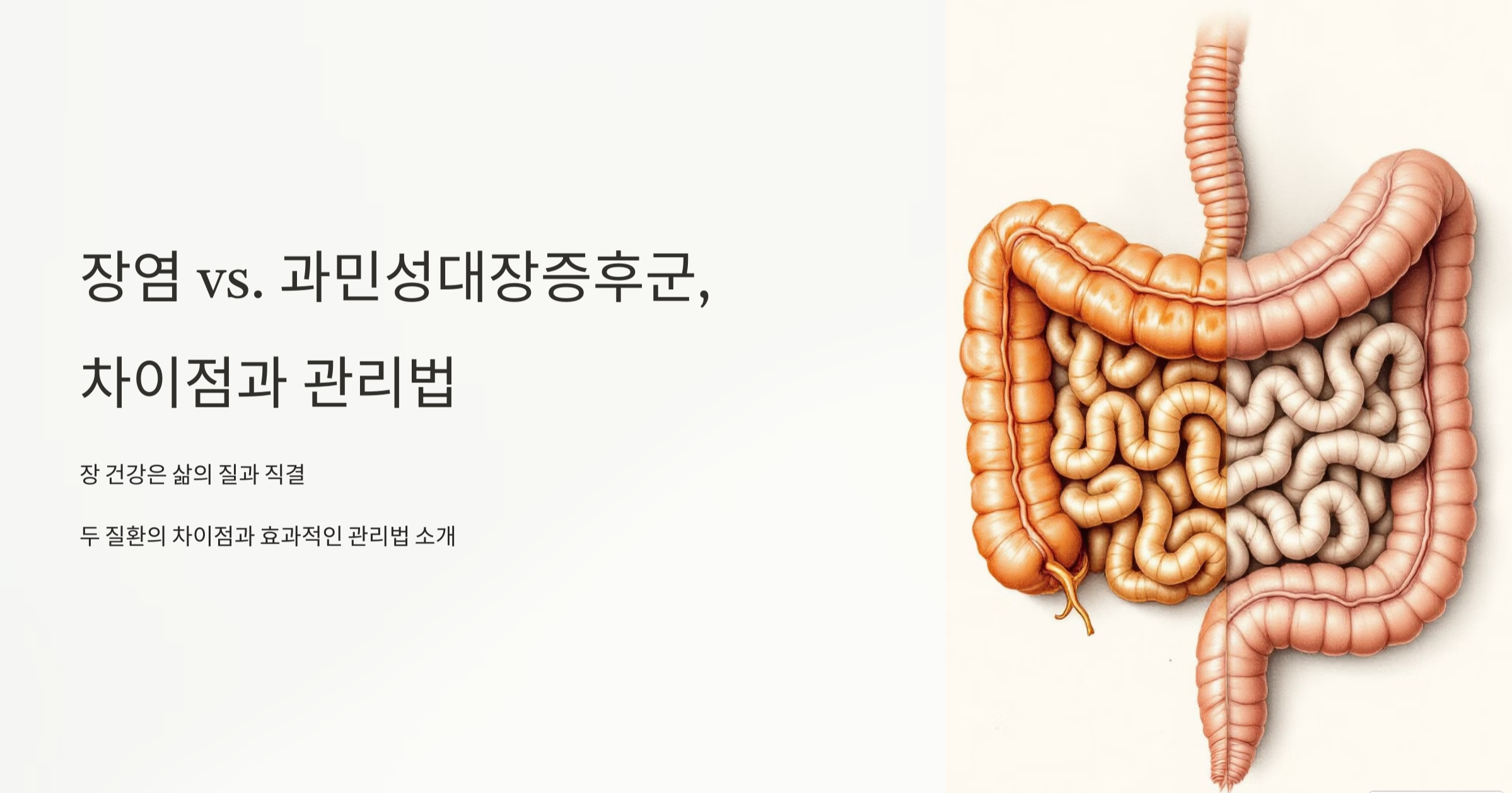 장염 과민성대장증후군 차이와 관리법 메인 사진