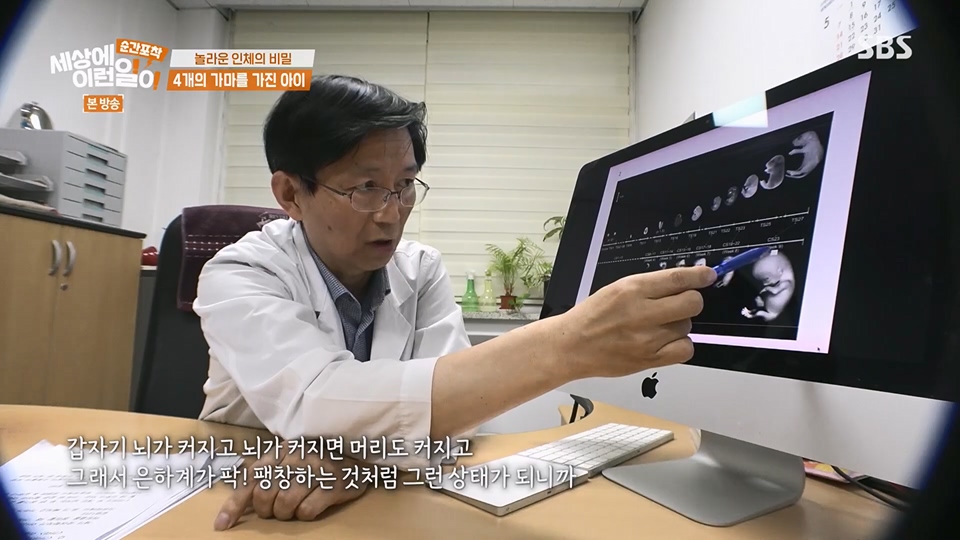 순간포착 세상에 이런일이.E1236.230708p.H264-F1RST.mp4_20230709_171128.824.jpg
