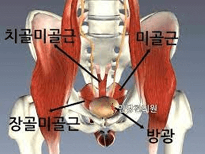 골반통증원인3가지