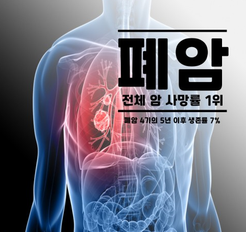  흡연과 폐암