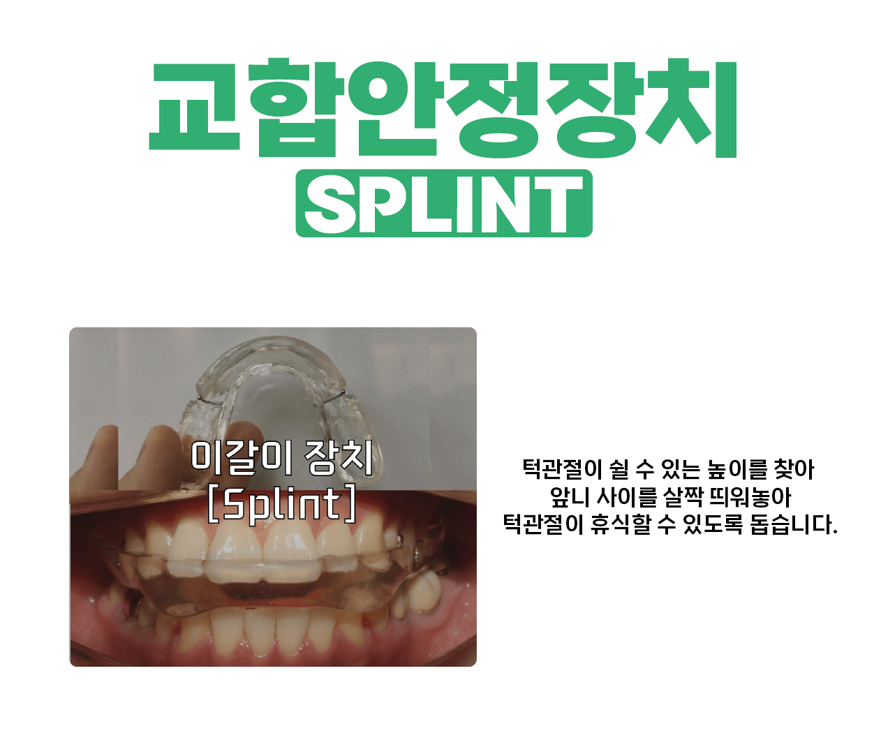 교합안정장치-이갈이-장치