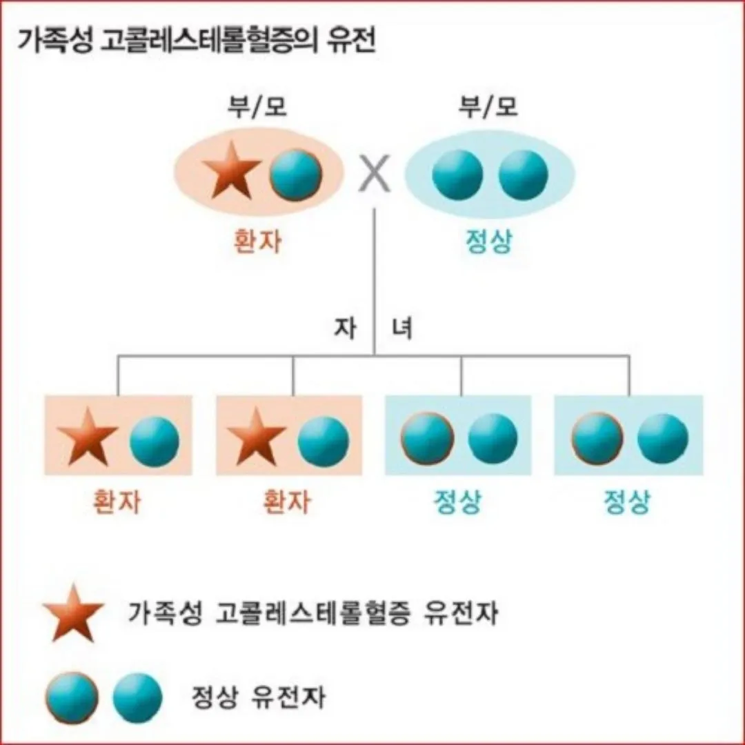 고지혈증 증상과 원인