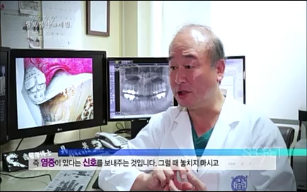 [670회] 생로병사의 비밀 - KBS670회] 생로병사의 비밀.ts_20220505_143216.778.jpg