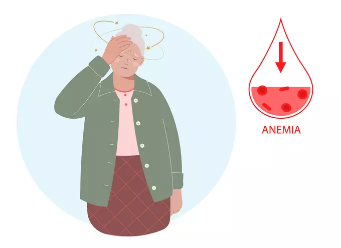 빈혈 (Anemia)