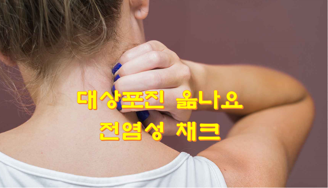  대상포진 옮나요 전염성 채크