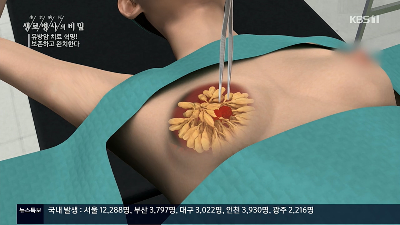 생로병사의 비밀.E845.221131p.H264-F1RST.mp4_20221201_215314.897.jpg