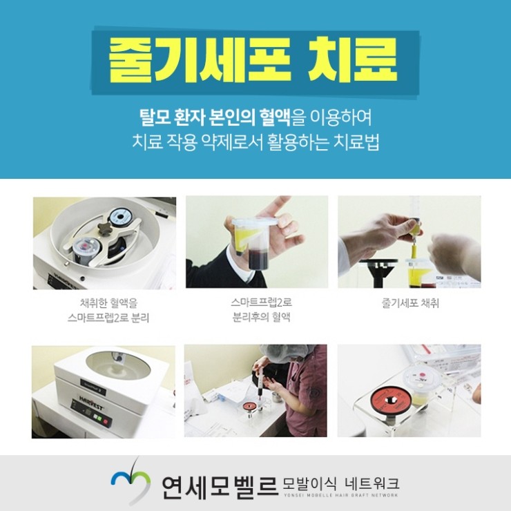 효과적인 치료를 원한다면 대전탈모 더욱 2