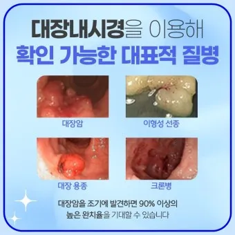대장내시경 당일식사 주의사항 피해야 하는 음식_45