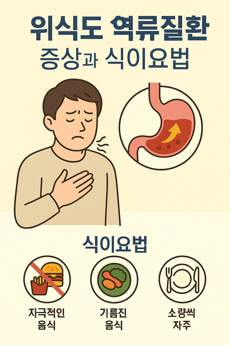 위식도 역류질환 증상과 식이요법