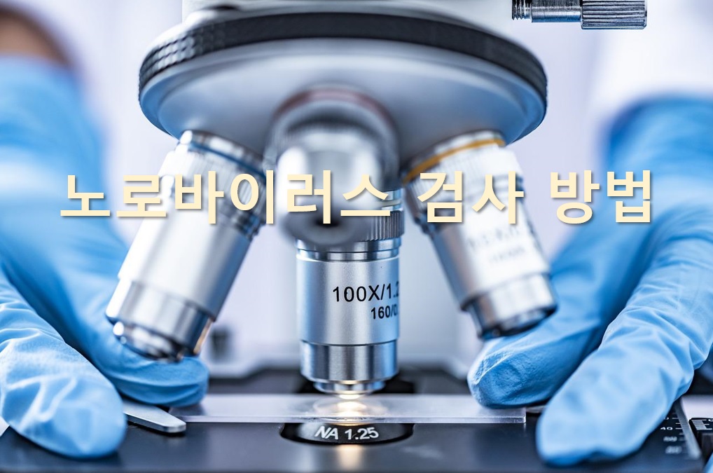  구토와 설사 증상을 일으키는 노로바이러스 검사 방법과 치료