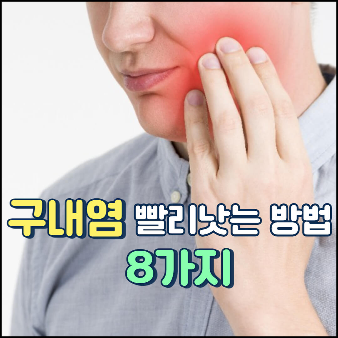  구내염 빨리 낫는법 - 효과적인 홈케어 방법 8가지