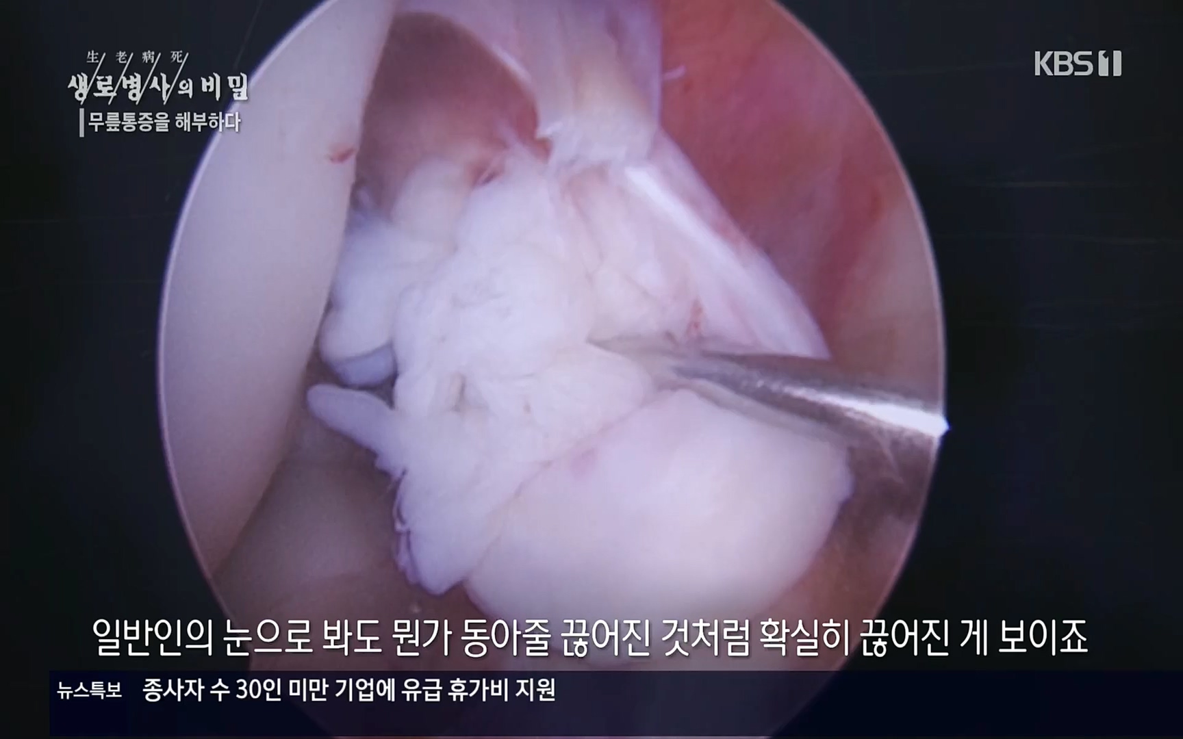 생로병사의 비밀.E834.220907p.H264-F1RST.mp4_20220908_210425.138.jpg